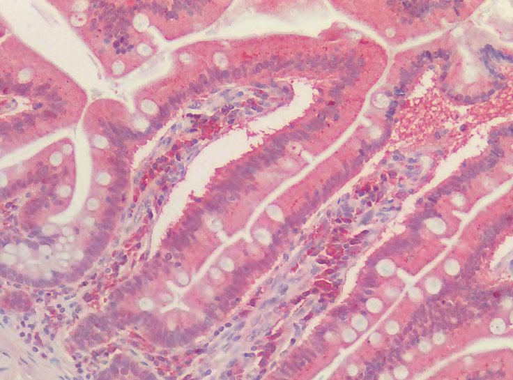 PRDX1 Antibody