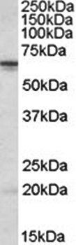 STK39/SPAK Antibody