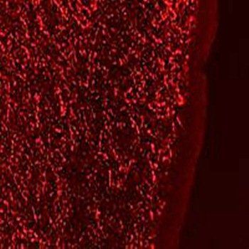 GAL Antibody