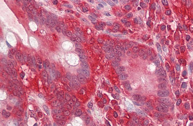 GNB2L1 Antibody