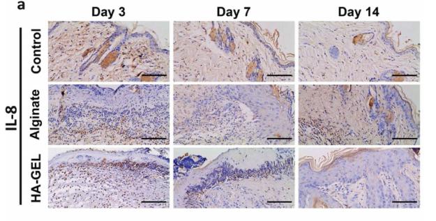 IL8 Antibody