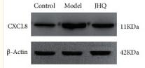 IL8 Antibody