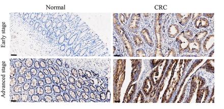 IL8 Antibody