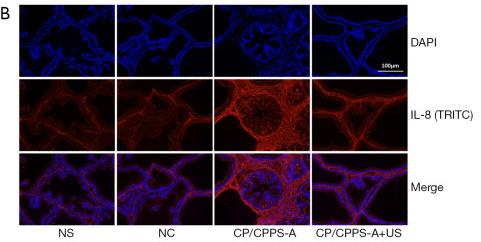 IL8 Antibody