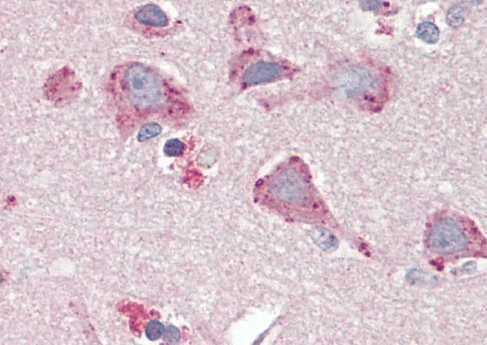 BMP1 (aa284-296) Antibody
