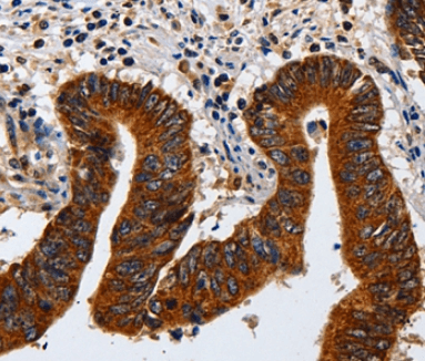 KRT23 Rabbit Polyclonal Antibody