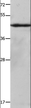 KRT23 Rabbit Polyclonal Antibody