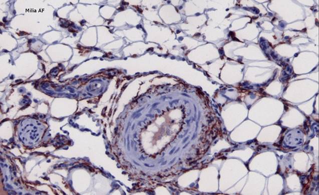 CD34 Rabbit Polyclonal Antibody