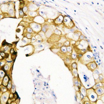 Cytokeratin 19/KRT19 Rabbit Polyclonal Antibody