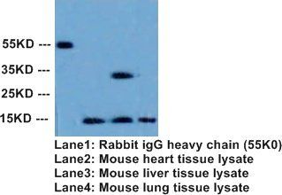 Superoxide Dismutase 1/SOD1 Rabbit Polyclonal Antibody