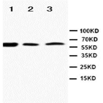 RANK/TNFRSF11A Rabbit Polyclonal Antibody