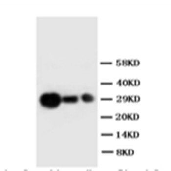 Metalloproteinase inhibitor 1 TIMP1 Rabbit Polyclonal Antibody