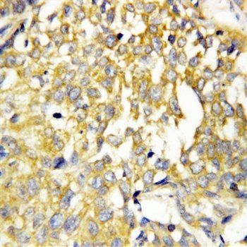 Pleiotrophin/PTN Rabbit Polyclonal Antibody
