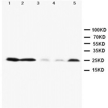 Pleiotrophin/PTN Rabbit Polyclonal Antibody