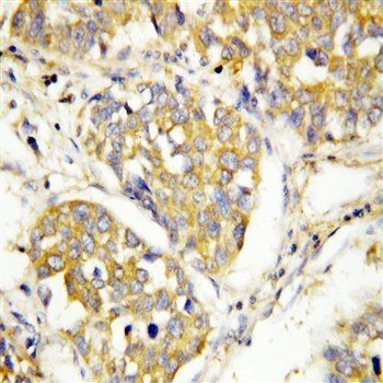 Toll-like receptor 4 TLR4 Rabbit Polyclonal Antibody