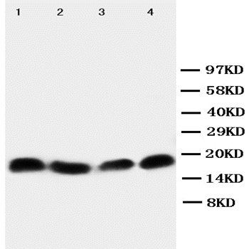 survivin/BIRC5 Rabbit Polyclonal Antibody