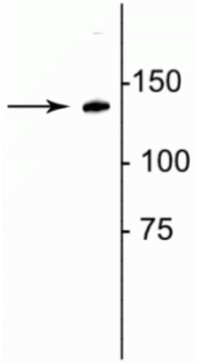 Collagen 1, alpha 1 telopeptide Antibody