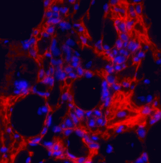 Collagen 1, alpha 1 telopeptide Antibody