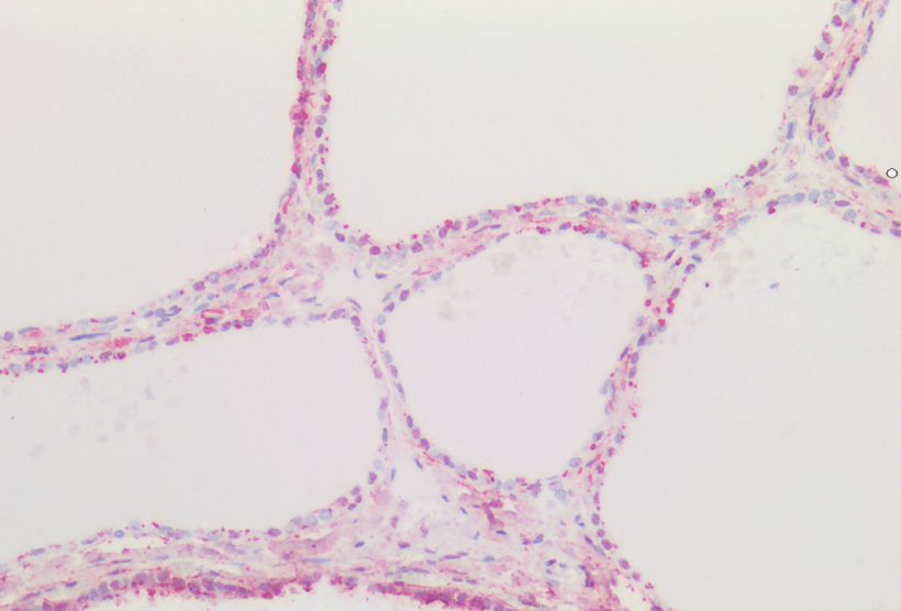CTGF (aa111-123) Antibody