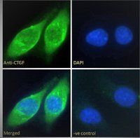CTGF (aa111-123) Antibody