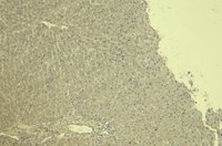 Connective Tissue Growth Factor Antibody