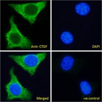 Connective Tissue Growth Factor Antibody