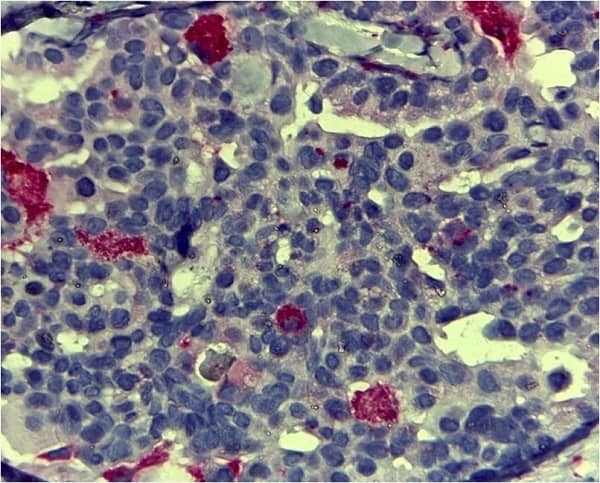 CD68 Antibody (RPE)