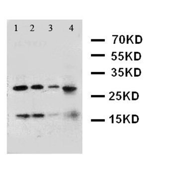Interferon gamma/IFNG Rabbit Polyclonal Antibody