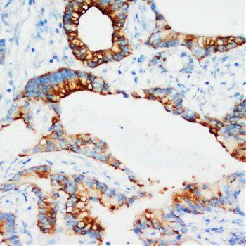 IGFBP3 Rabbit Polyclonal Antibody