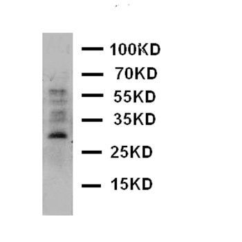 Aquaporin 8/AQP8 Rabbit Polyclonal Antibody