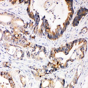 XIAP Rabbit Polyclonal Antibody