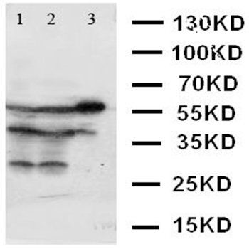 XIAP Rabbit Polyclonal Antibody