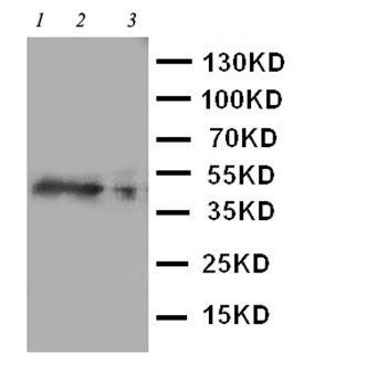 C-C chemokine receptor type 4 CCR4 Rabbit Polyclonal Antibody