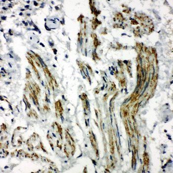 Caveolin-2/CAV2 Rabbit Polyclonal Antibody