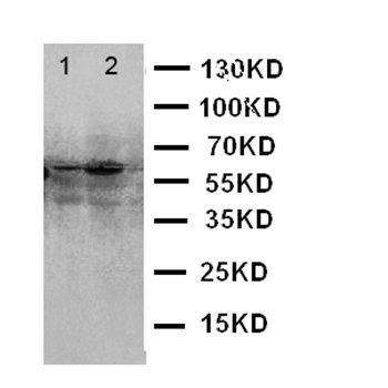 Transcription factor E2F1 E2F1 Rabbit Polyclonal Antibody