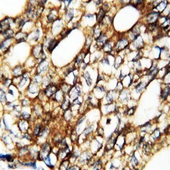 Fibroblast growth factor 1 FGF1 Rabbit Polyclonal Antibody