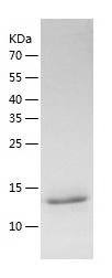Mouse IL-31 Protein, His Tag