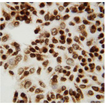 C-terminal-binding protein 2 CTBP2 Rabbit Polyclonal Antibody