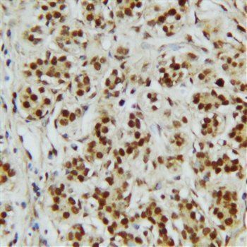 C-terminal-binding protein 2 CTBP2 Rabbit Polyclonal Antibody