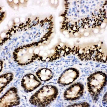 C-terminal-binding protein 2 CTBP2 Rabbit Polyclonal Antibody