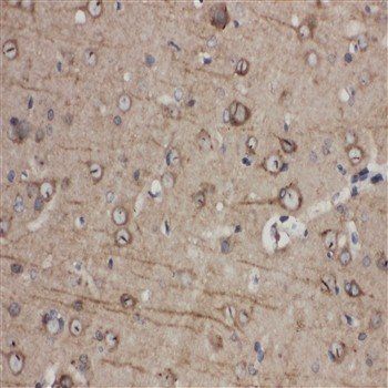Eph receptor A1/EPHA1 Rabbit Polyclonal Antibody