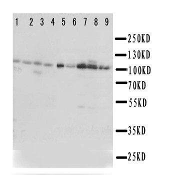 Eph receptor A1/EPHA1 Rabbit Polyclonal Antibody