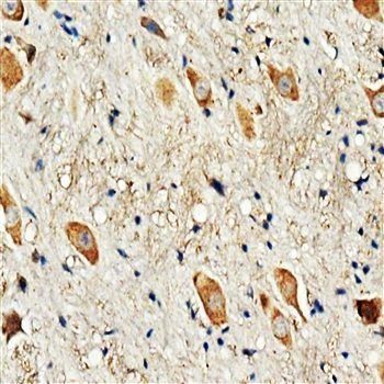 Dopamine Receptor D3/DRD3 Rabbit Polyclonal Antibody