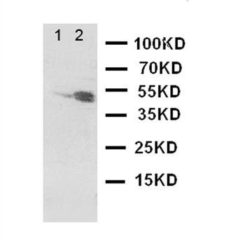 Dopamine Receptor D3/DRD3 Rabbit Polyclonal Antibody