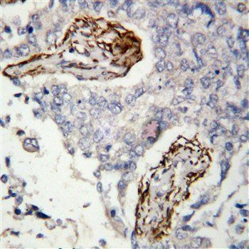 Histone deacetylase 8 HDAC8 Rabbit Polyclonal Antibody