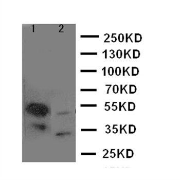 Histone deacetylase 8 HDAC8 Rabbit Polyclonal Antibody