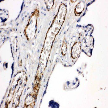 CD168/HMMR Rabbit Polyclonal Antibody