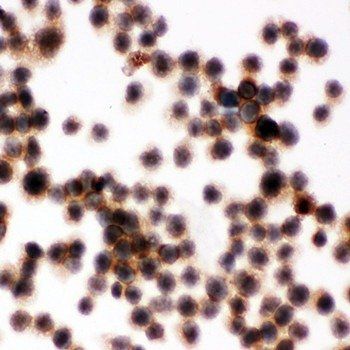 CD45/PTPRC Rabbit Polyclonal Antibody