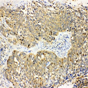 Haptoglobin/HP Rabbit Polyclonal Antibody