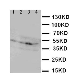 IL3RA Rabbit Polyclonal Antibody